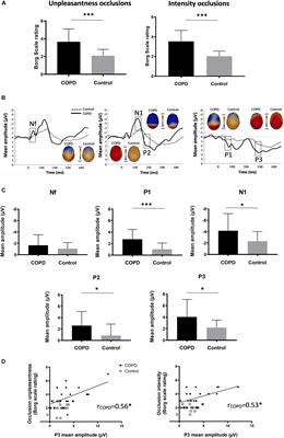 Brain Activations to Dyspnea in Patients With COPD